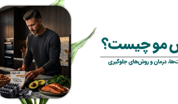 ریزش-مو-1
