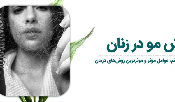 ریزش-مو-در-زنان