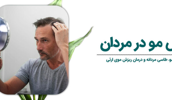 ریزش-مو-در-مردان