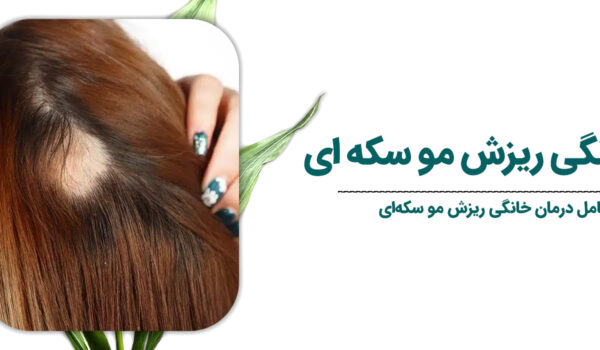 درمان-خانگی-ریزش-مو-سکه-ای