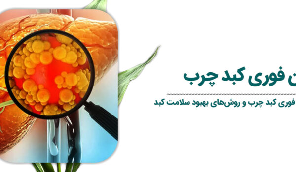 درمان-فوری-کبد-چرب