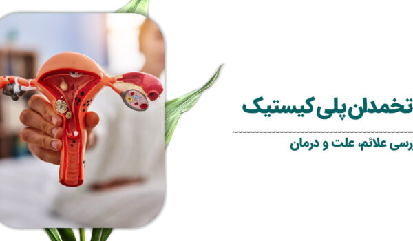 سندرم-تخمدان-پلی-کیستیک