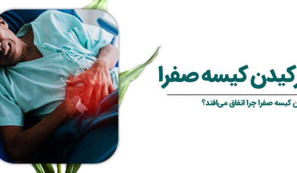 علائم ترکیدن کیسه صفرا​