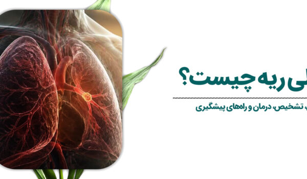 آمبولی ریه