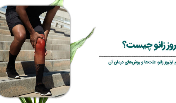 زانو چیست؟