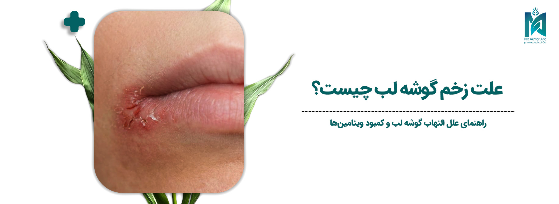 علت-زخم-گوشه-لب-چیست؟